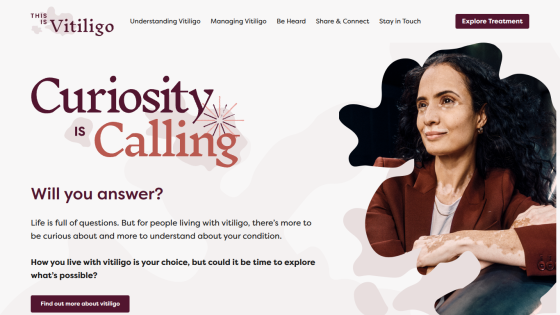 Website about vitiligo with headline 'Curiosity is Calling' and a woman with vitiligo looking thoughtful